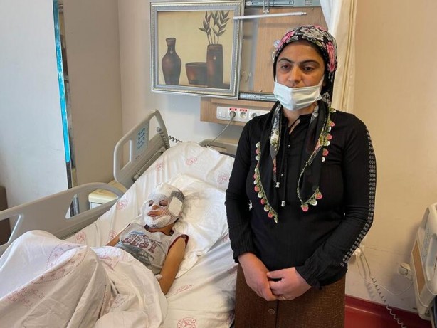 Foto - Başıboş köpeklerin 7 yaşındaki çocuğu ağır yaralamasının ardından vatandaşlar ayağa kalktı!