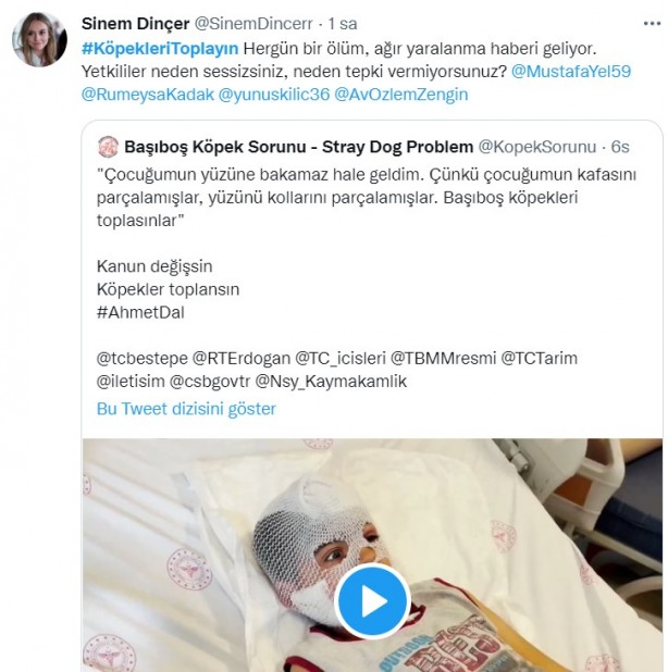 Foto - Başıboş köpeklerin 7 yaşındaki çocuğu ağır yaralamasının ardından vatandaşlar ayağa kalktı!