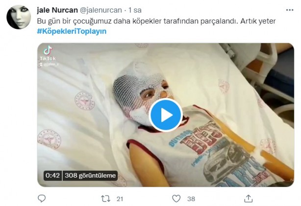 Foto - Başıboş köpeklerin 7 yaşındaki çocuğu ağır yaralamasının ardından vatandaşlar ayağa kalktı!