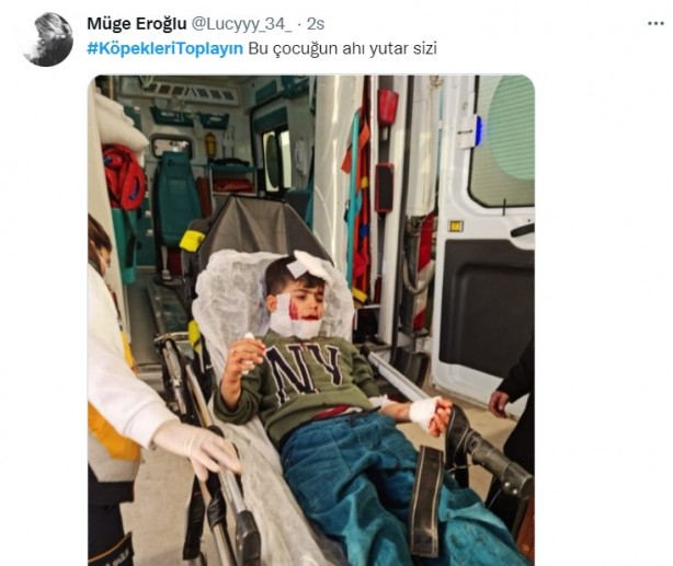 Foto - Başıboş köpeklerin 7 yaşındaki çocuğu ağır yaralamasının ardından vatandaşlar ayağa kalktı!