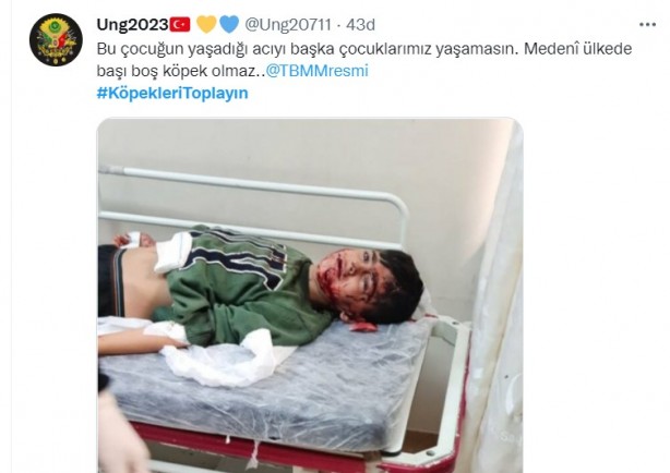 Foto - Başıboş köpeklerin 7 yaşındaki çocuğu ağır yaralamasının ardından vatandaşlar ayağa kalktı!