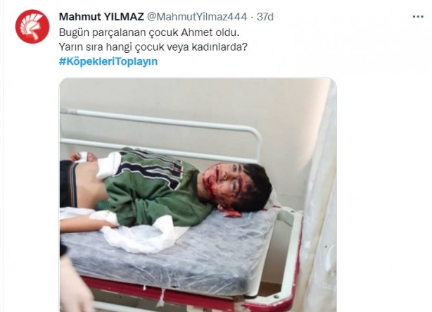 Foto - Başıboş köpeklerin 7 yaşındaki çocuğu ağır yaralamasının ardından vatandaşlar ayağa kalktı!