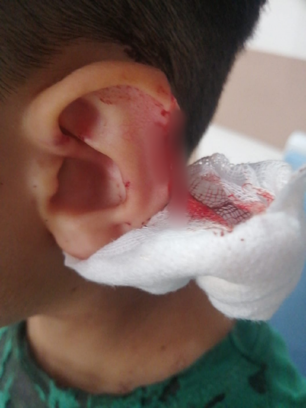 Foto - Köpekperestlerin barınaklardan kaçırdığı pitbull'lar dehşet saçıyor! Küçük çocuğun dudağı ve kulağı parçalandı