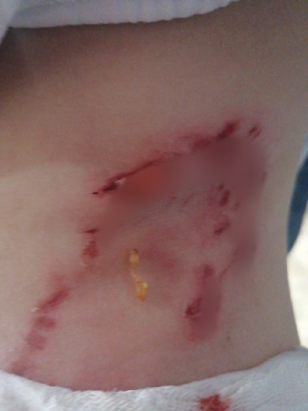 Foto - Köpekperestlerin barınaklardan kaçırdığı pitbull'lar dehşet saçıyor! Küçük çocuğun dudağı ve kulağı parçalandı