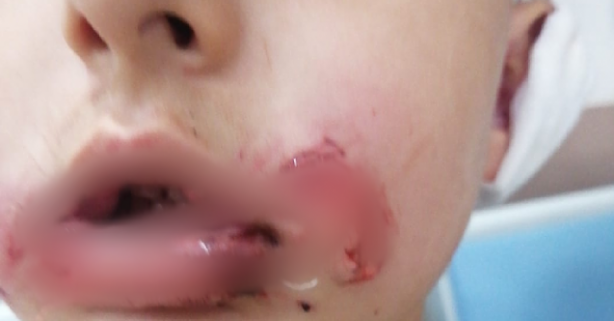 Köpekperestlerin barınaklardan kaçırdığı pitbull'lar dehşet saçıyor! Küçük çocuğun dudağı ve kulağı parçalandı