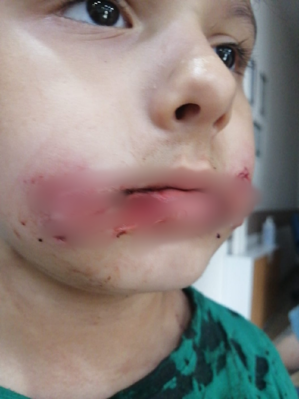 Foto - Köpekperestlerin barınaklardan kaçırdığı pitbull'lar dehşet saçıyor! Küçük çocuğun dudağı ve kulağı parçalandı