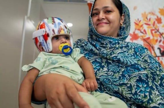 Foto - Başkan Erdoğan talimat vermişti! Pakistanlı yapışık ikizler birbirinden ayrıldı