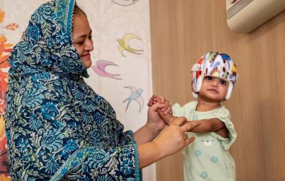 Foto - Başkan Erdoğan talimat vermişti! Pakistanlı yapışık ikizler birbirinden ayrıldı