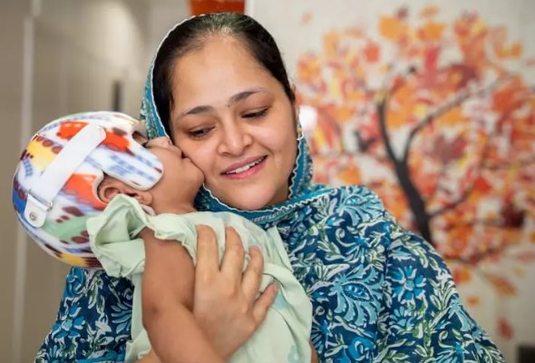 Foto - Başkan Erdoğan talimat vermişti! Pakistanlı yapışık ikizler birbirinden ayrıldı