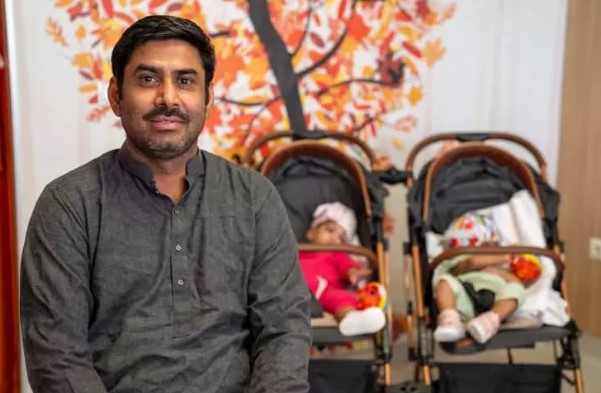 Foto - Başkan Erdoğan talimat vermişti! Pakistanlı yapışık ikizler birbirinden ayrıldı