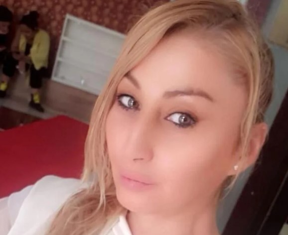 Foto - Batılı yaşam tarzının son eseri: Güzellik uğruna dudağından oldu!