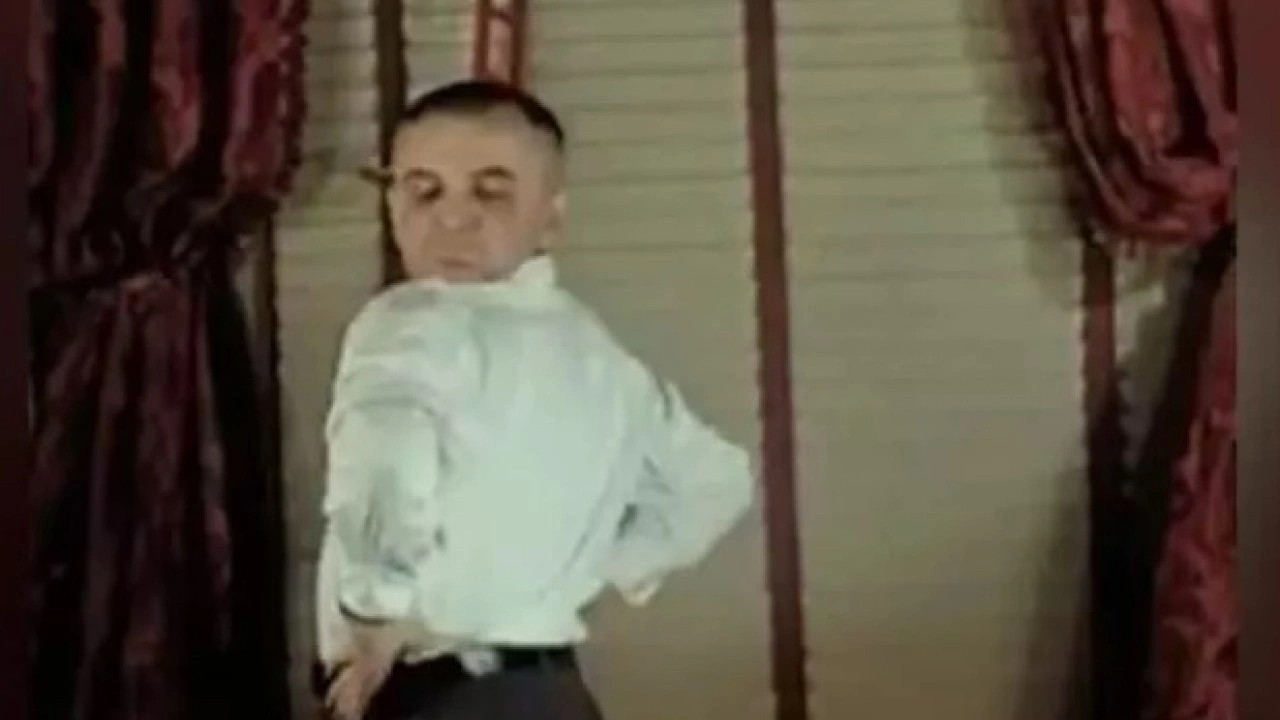 Foto - 'Baykuş adam' dünyayı şaşırtıyor: Başını 180 derece çevirebiliyor!