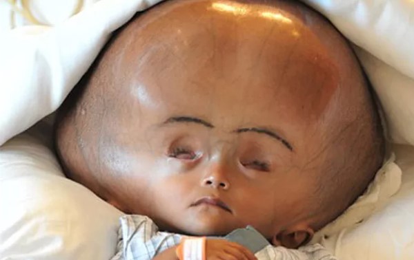 Foto - Bazılarının elleri ağaç oluyor, bazılarının bütün vücudu tüylerle kaplanıyor! İşte dünyadaki en garip hastalıklarI