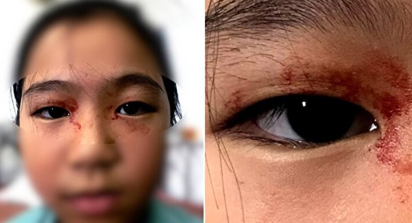 Foto - Bazılarının elleri ağaç oluyor, bazılarının bütün vücudu tüylerle kaplanıyor! İşte dünyadaki en garip hastalıklarI