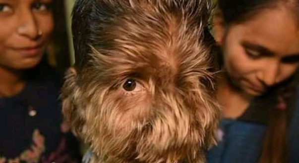 Foto - Bazılarının elleri ağaç oluyor, bazılarının bütün vücudu tüylerle kaplanıyor! İşte dünyadaki en garip hastalıklarI