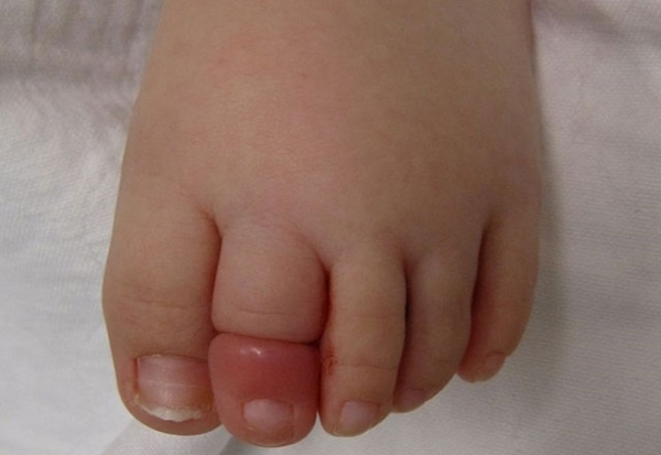 Foto - Bebeğiniz durmadan ağlıyorsa ayaklarına bakın! Çünkü...