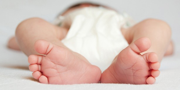 Foto - Bebeklerde kalça çıkığı nedir, nasıl anlaşılır? Bebeklerde kalça çıkığı belirtileri ve tedavisi