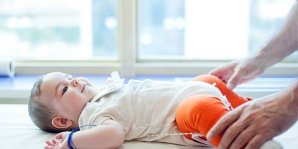 Foto - Bebeklerde kalça çıkığı nedir, nasıl anlaşılır? Bebeklerde kalça çıkığı belirtileri ve tedavisi