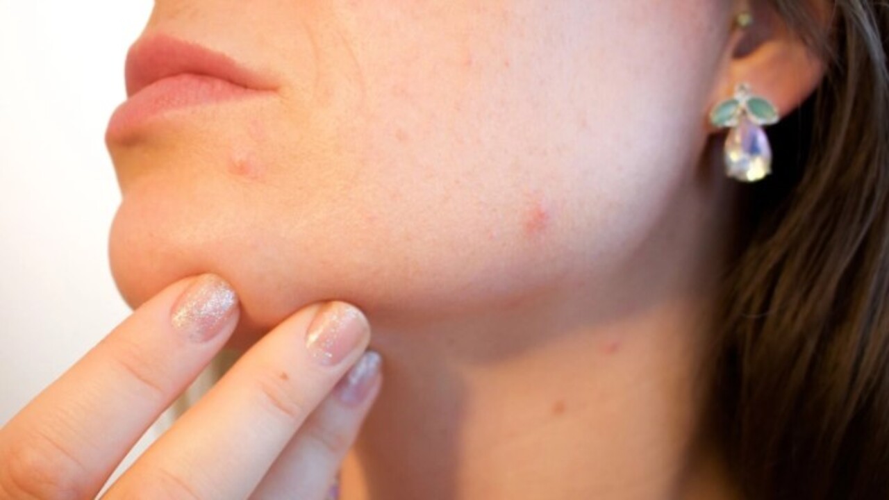 Foto - Bebeksi bir cilde sahip olacaksınız! İşte sivilcelerden ve aknelerden kurtulmanın kolay yolu