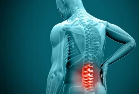 Foto - Bel fıtığı hakkında doğru sanılan 10 yanlış!