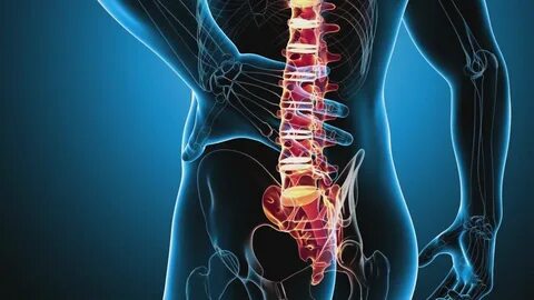 Foto - Bel fıtığı hakkında doğru sanılan 10 yanlış!