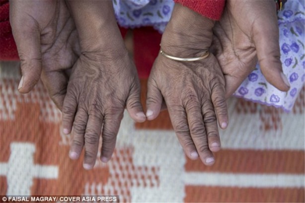 Foto - 'Benjamin Button' çocuklar