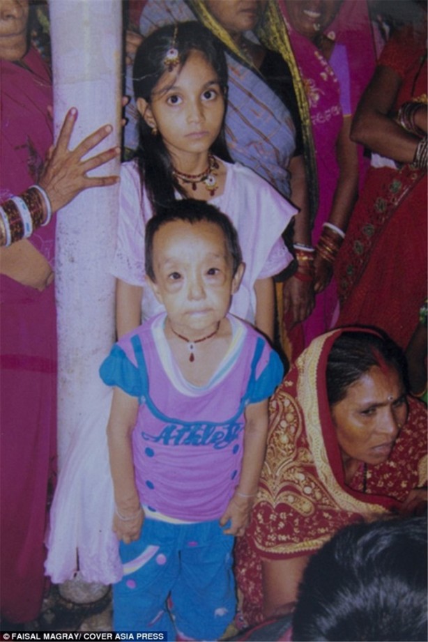 Foto - 'Benjamin Button' çocuklar