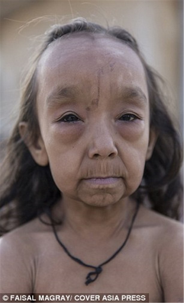 Foto - 'Benjamin Button' çocuklar