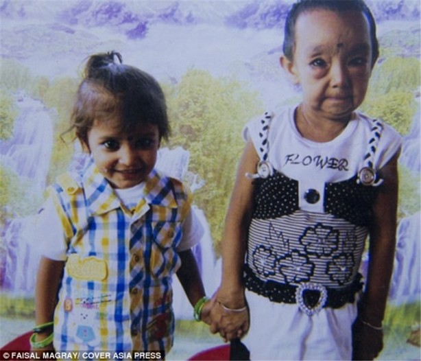 Foto - 'Benjamin Button' çocuklar