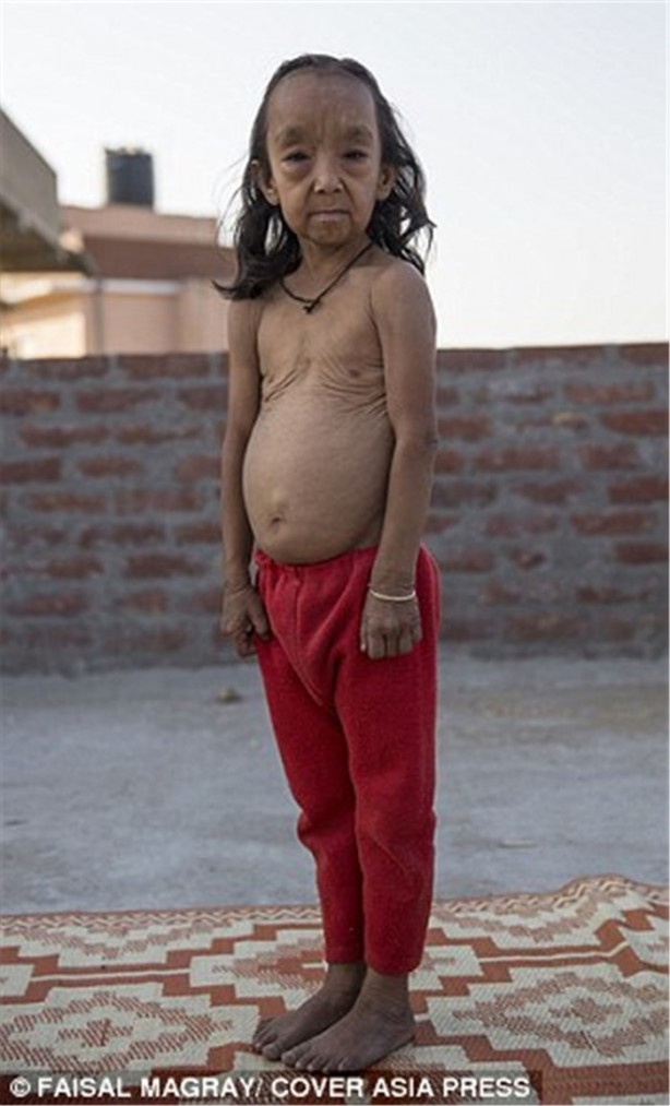 Foto - 'Benjamin Button' çocuklar