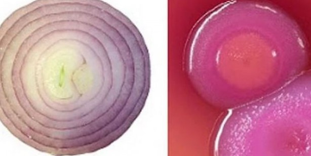 Foto - Benzediği organa şifa veren 10 yiyecek