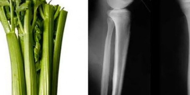 Foto - Benzediği organa şifa veren 10 yiyecek