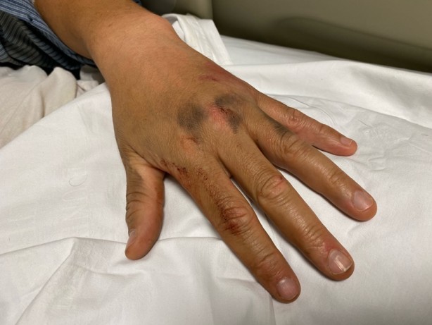 Foto - Beyaz kod veren aile hekimi darbedildi