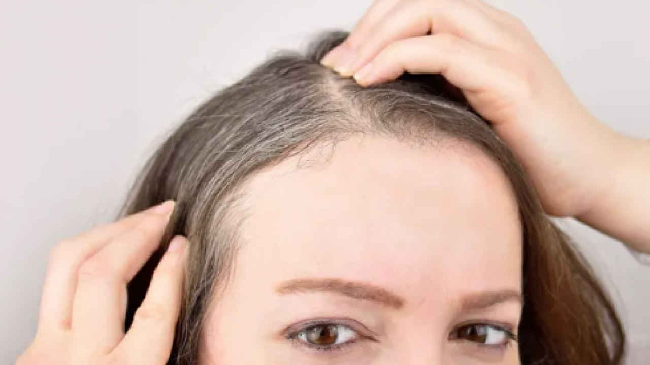 Beyaz saçlar aslında vücudu koruyor olabilir... Yaşlanmanın işareti sanıyorduk oysa ki!