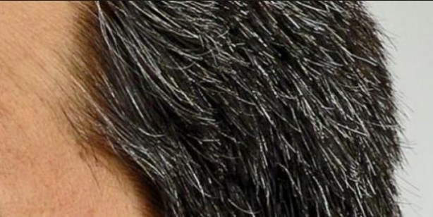 Foto - Beyaz saçlara veda ettiren kür