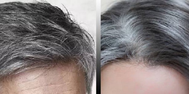 Foto - Beyaz saçlara veda ettiren kür