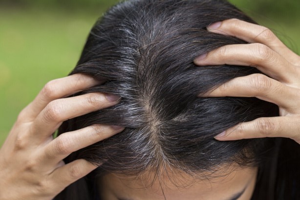 Foto - Beyaz saçlara veda ettiren kür