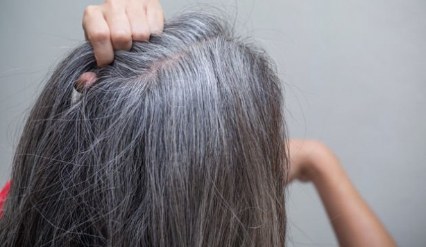 Foto - Beyaz saçlara veda ettiren kür