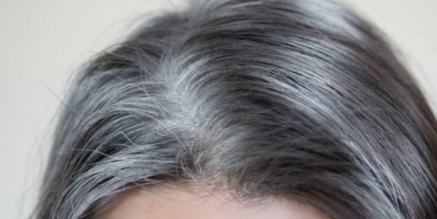 Foto - Beyaz saçlardan patates ile kurtulun: Saç beyazlamasının dermanı doğal yolu ezberleri bozdu! Değişiklik yapın