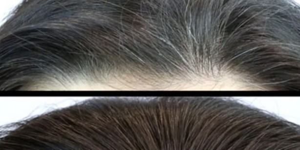 Beyaz saçlardan patates ile kurtulun: Saç beyazlamasının dermanı doğal yolu ezberleri bozdu! Değişiklik yapın