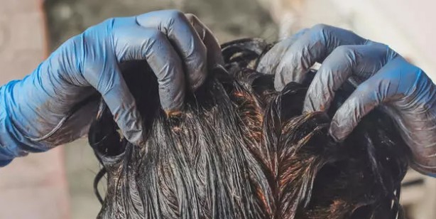 Foto - Beyaz saçlardan patates ile kurtulun: Saç beyazlamasının dermanı doğal yolu ezberleri bozdu! Değişiklik yapın