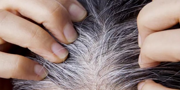 Foto - Beyaz saçlardan patates ile kurtulun: Saç beyazlamasının dermanı doğal yolu ezberleri bozdu! Değişiklik yapın