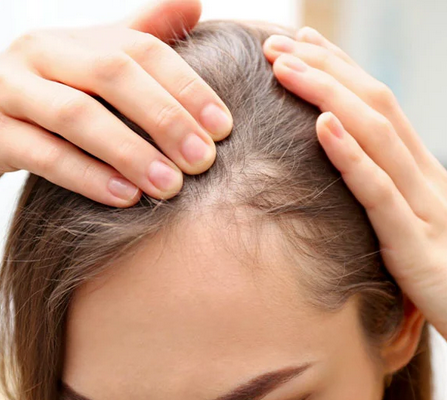 Foto - Beyaz saçları yok eden saç dökülmesini durduran bitkisel kür: Saçlarınız kökünden fışkıracak!