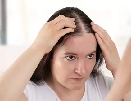 Foto - Beyaz saçları yok eden saç dökülmesini durduran bitkisel kür: Saçlarınız kökünden fışkıracak!