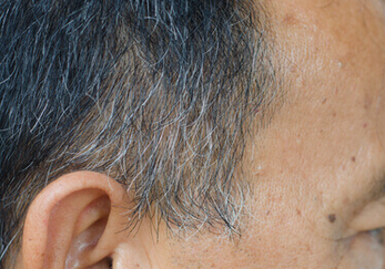 Foto - Beyazlayan saçları tamamen doğal yolla eski haline döndürmek: İlaçlara taş çıkartacak! Anında kapatan kür!