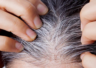 Foto - Beyazlayan saçları tamamen doğal yolla eski haline döndürmek: İlaçlara taş çıkartacak! Anında kapatan kür!