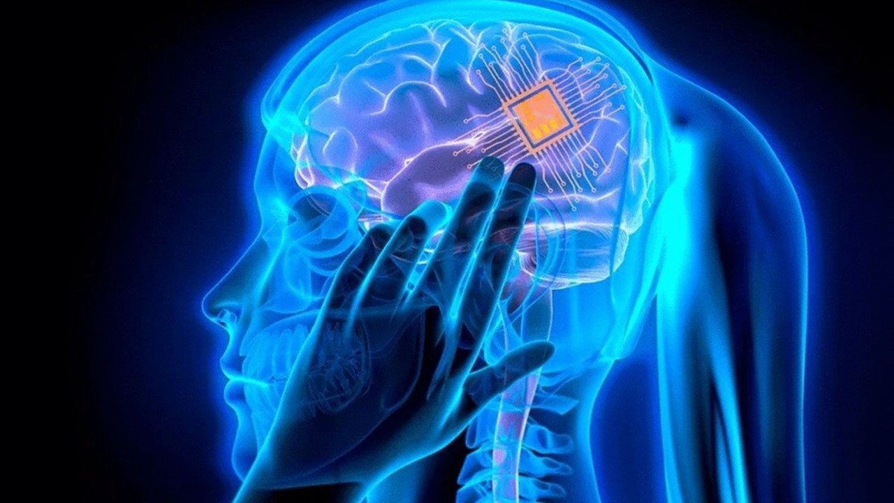 Foto - Beyin çipi zihinden geçen sözleri sese çevirdi!