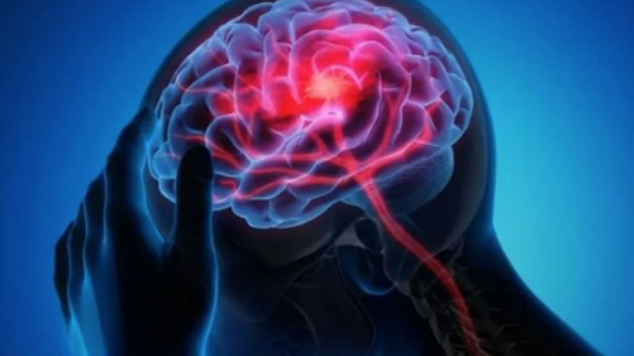 Beyin kütlesinin %90'ı eksik olan bir adam keşfedildi: Buna rağmen... Büyük şok etkisi!