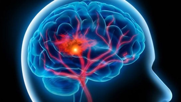  Beyin sağlığınızı korumak için...