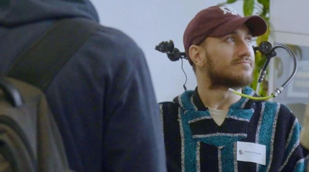 Foto - Beynine Neuralink çipi takılan kişiden açıklamalar! Neuralink beyin çipi nasıl çalışıyor?